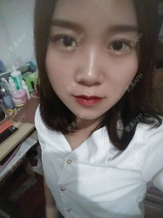 更美 - 圆方脸课代表ʚ😊ɞ的半永久妆经验 | 半永久妆 | 武汉