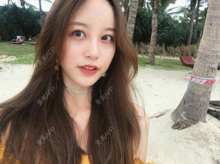 更美 - 君君静的树脂补牙经验 | 树脂补牙 | 成都