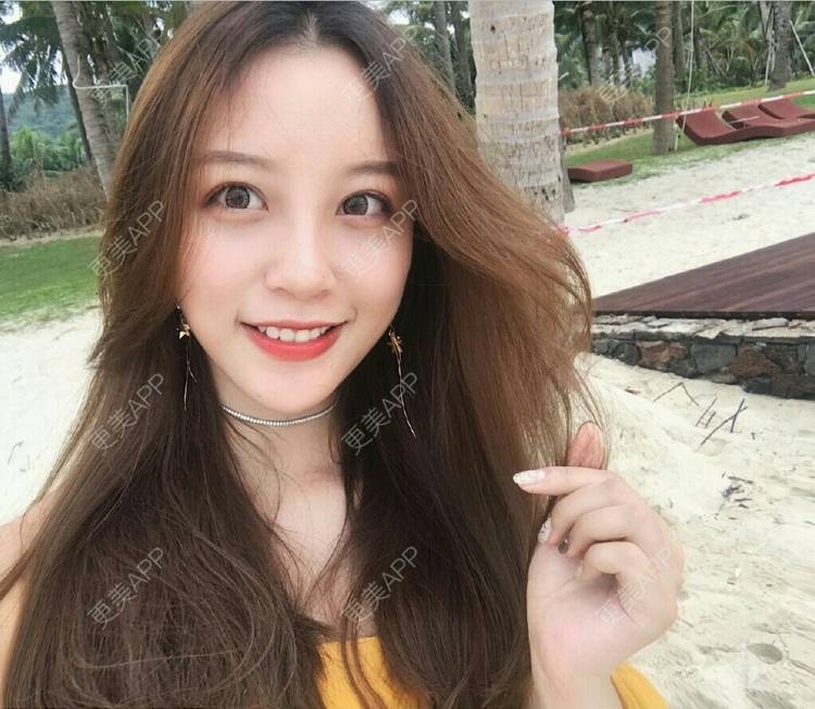 更美 - 君君静的树脂补牙经验 | 树脂补牙 | 成都