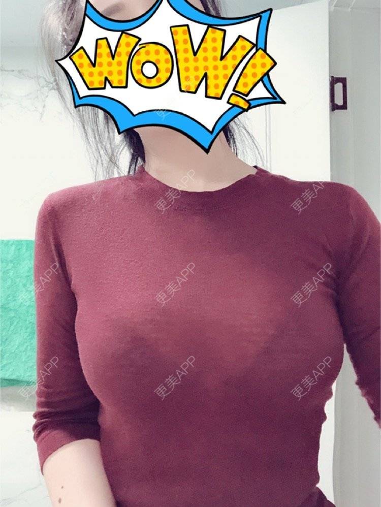 施锦的丰胸隆胸日记