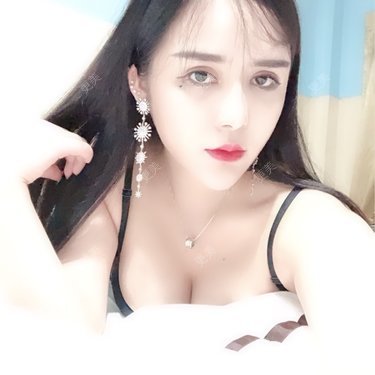 双眼皮修复