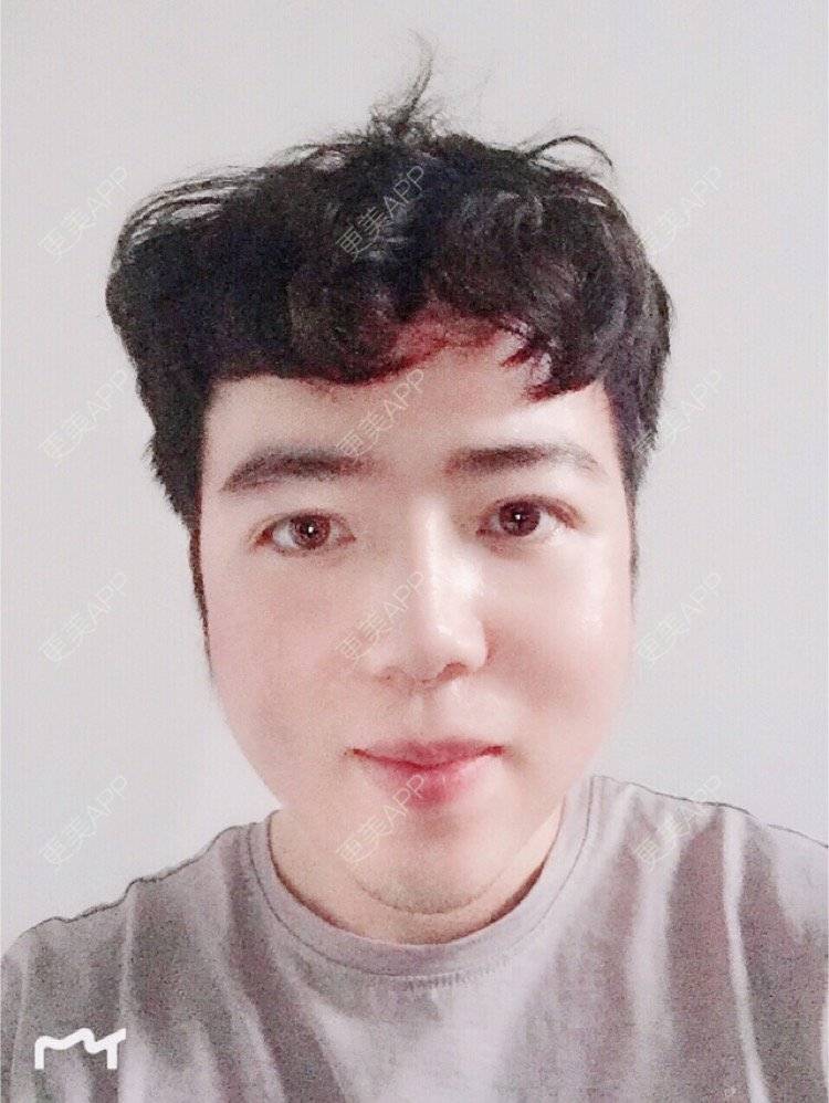 更美 - 叮当猫的时光机的硅胶垫下巴经验 | 硅胶垫下巴 | 杭州