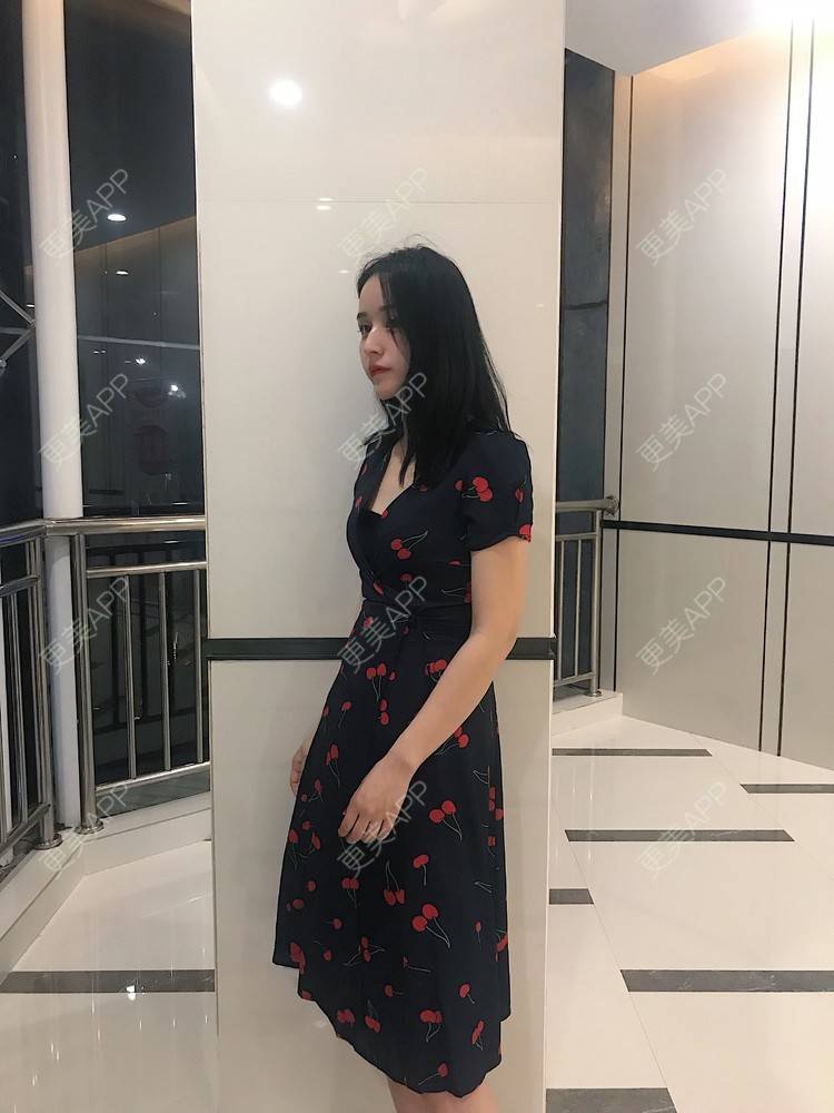 更美 - 葡萄啊香蕉的微针淡化妊娠纹经验 | 郑州 | 微针淡化妊娠纹