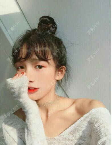 更美 - 后知不觉的树脂补牙经验 | 树脂补牙 | 成都