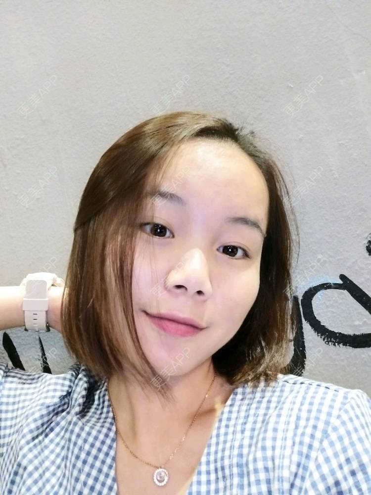 更美 - 王芳 医生的经验 | 北京 | 唇形 | 上海 | 假体隆胸 | 鼻部综合 | 鼻部多项 | 长沙 | 广州 | 深圳 | 吸脂 | 南京 | 玻尿酸 | 西安 | 重庆 | 杭州 | 全瓷牙 | 埋线提升 | 哈尔滨 | 冷光美白