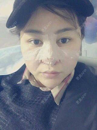 更美用户pTU2umuulo的鼻综合