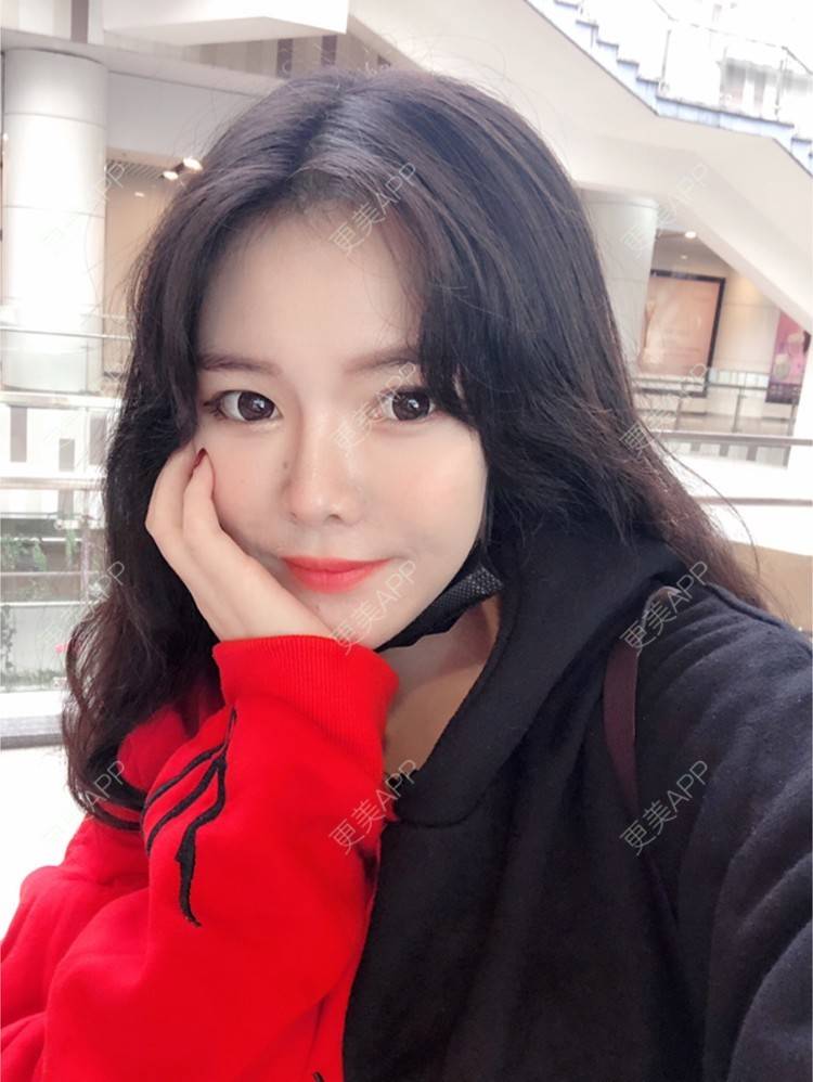 更美 - yuki666的玻尿酸经验 | 深圳 | 像素激光 | 鼻部综合 | 胸部修复 | 杭州 | 武汉 | 玻尿酸