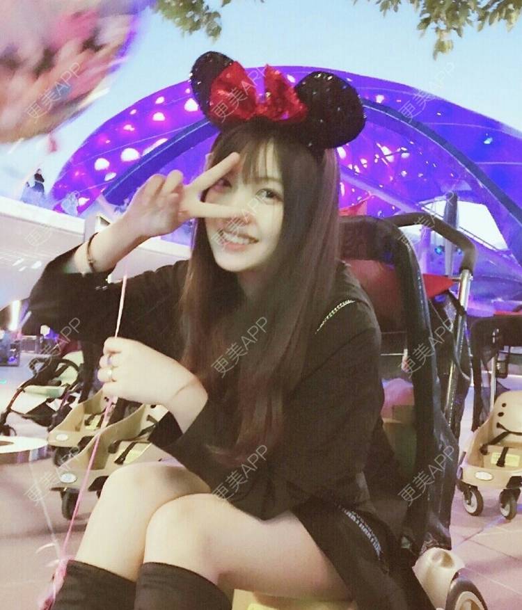 更美 - 留佳斯的冷光美白经验 | 成都 | 冷光美白