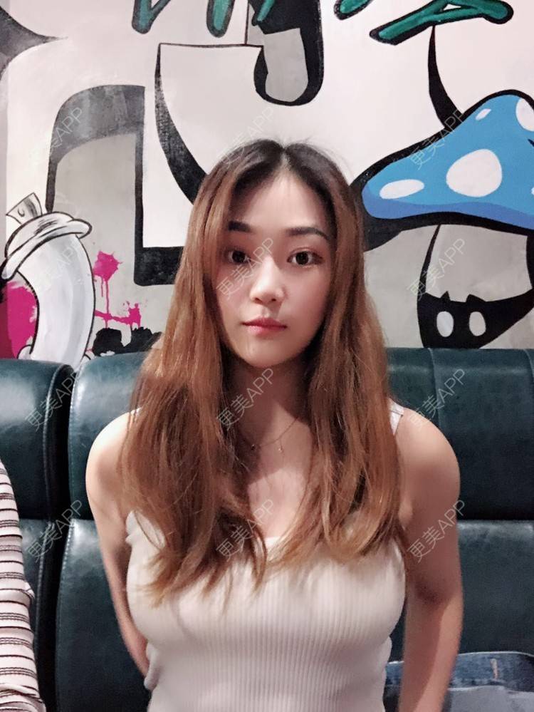 自体脂肪隆胸前后对比照_更美用户uphn475kbr_术后42天__更美