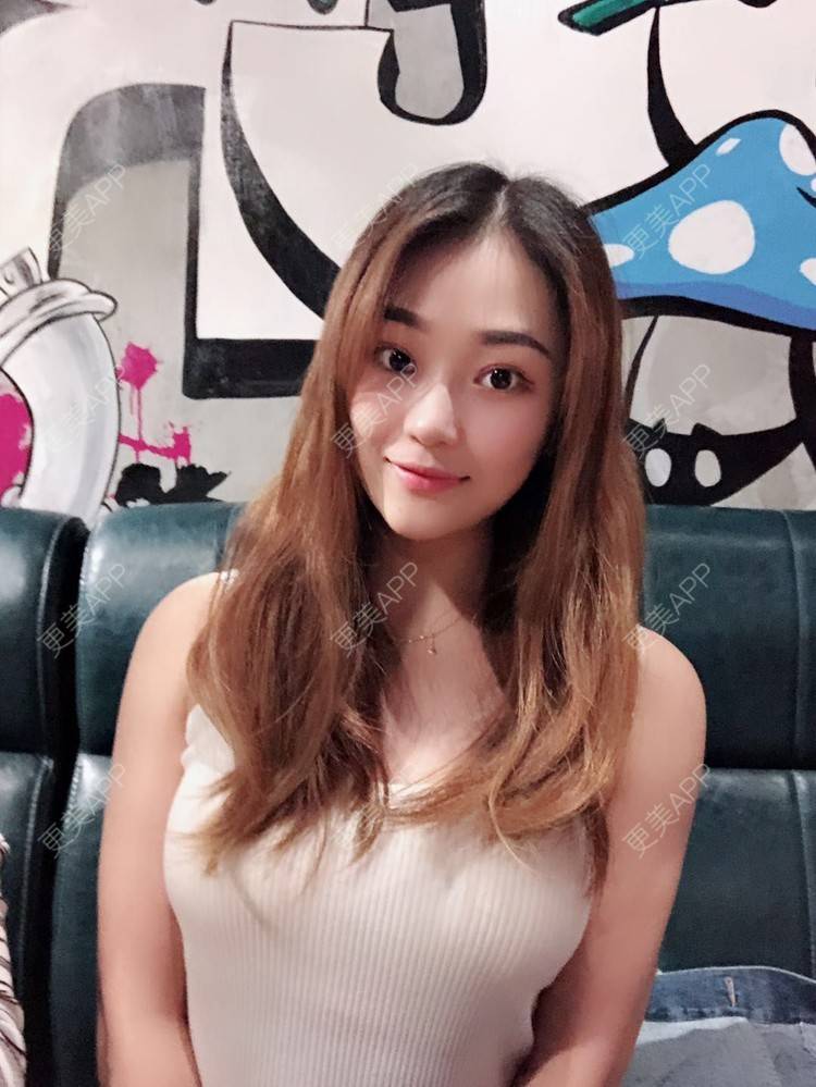 更美用户uphn475kbr的自体脂肪隆胸日记