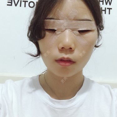 眼部多项