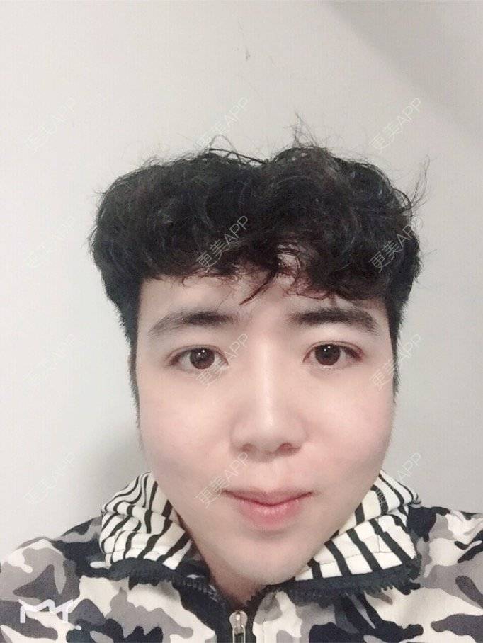 更美 - 叮当猫的时光机的硅胶垫下巴经验 | 杭州 | 硅胶垫下巴