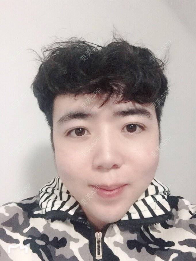 更美 - 叮当猫的时光机的硅胶垫下巴经验 | 杭州 | 硅胶垫下巴