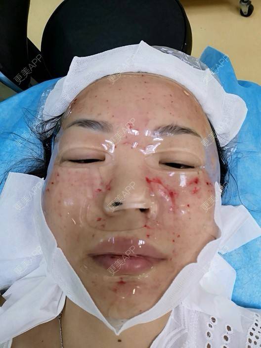 更美 - p&no的皮秒激光经验 | 上海 | 武汉 | 牙齿矫正 | 埋线隆鼻 | 皮秒激光 | 合肥