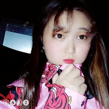 自体脂肪丰唇