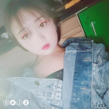 自体脂肪丰唇