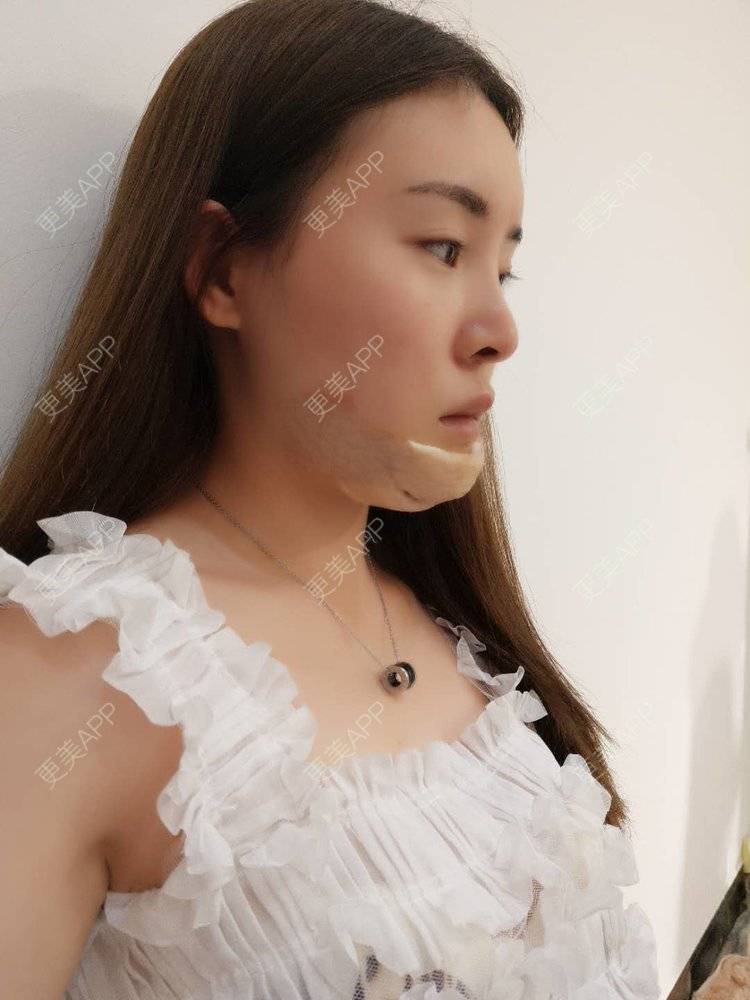 可爱肉嘟嘟的下巴日记