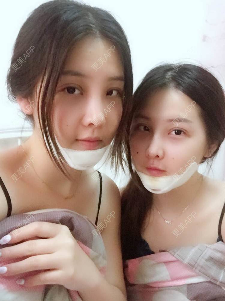 更美 - 如果你知道我知道的硅胶垫下巴经验 | 硅胶垫下巴 | 南宁