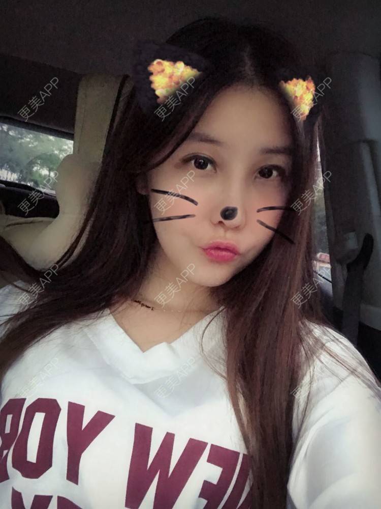 更美 - 如果你知道我知道的硅胶垫下巴经验 | 自体脂肪丰苹果肌 | 硅胶垫下巴 | 南宁