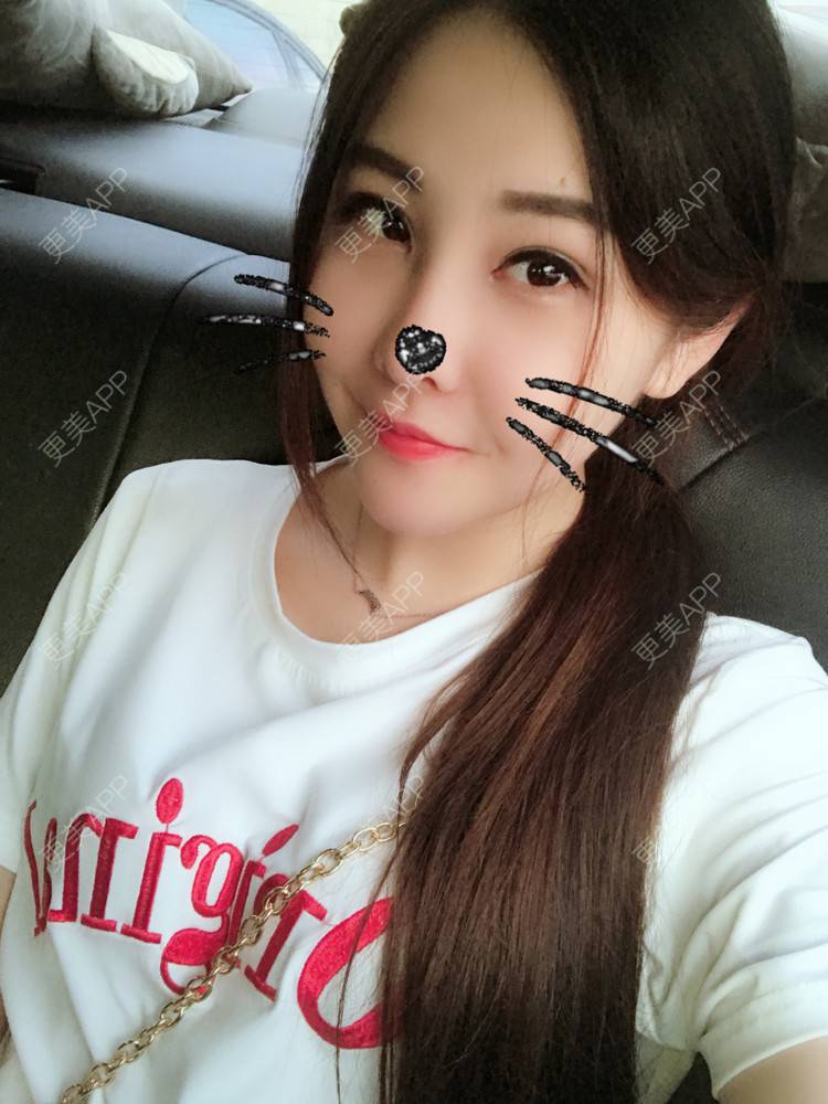 更美 - 如果你知道我知道的硅胶垫下巴经验 | 自体脂肪丰苹果肌 | 硅胶垫下巴 | 南宁