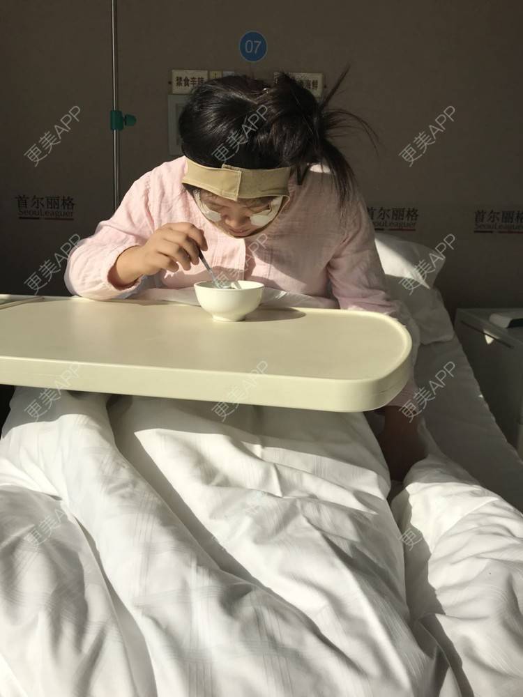 更美 - 更美用户ZvCr0tBgop的宽下巴矫正经验 | 宽下巴矫正