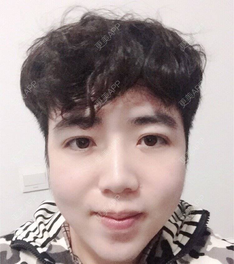 更美 - 叮当猫的时光机的硅胶垫下巴经验 | 杭州 | 硅胶垫下巴