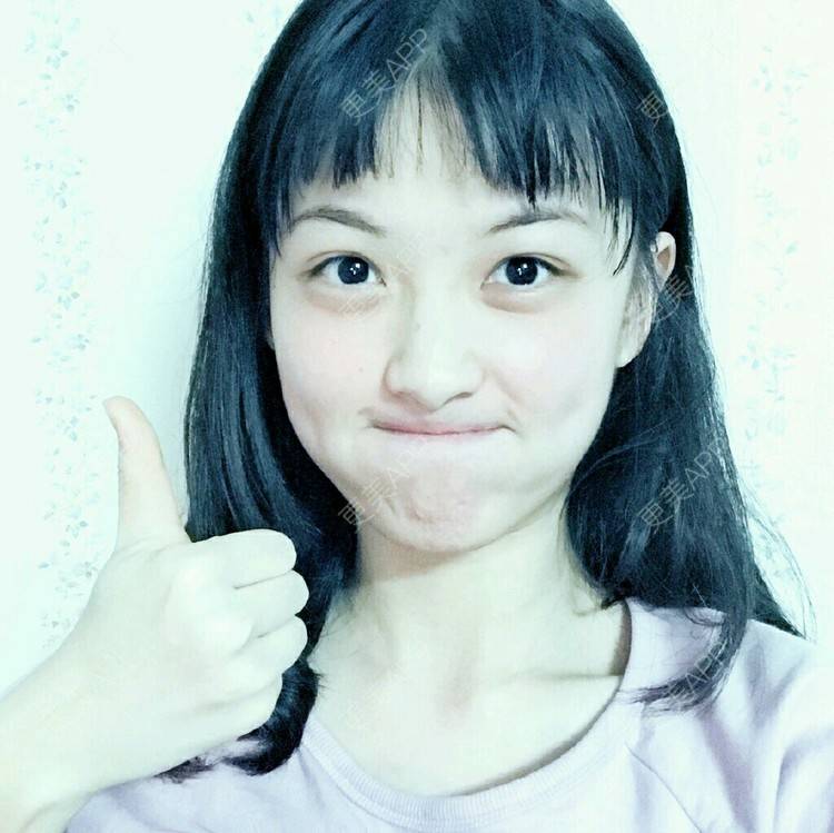 更美 - 春风吹梦的全瓷牙经验 | 成都 | 全瓷牙