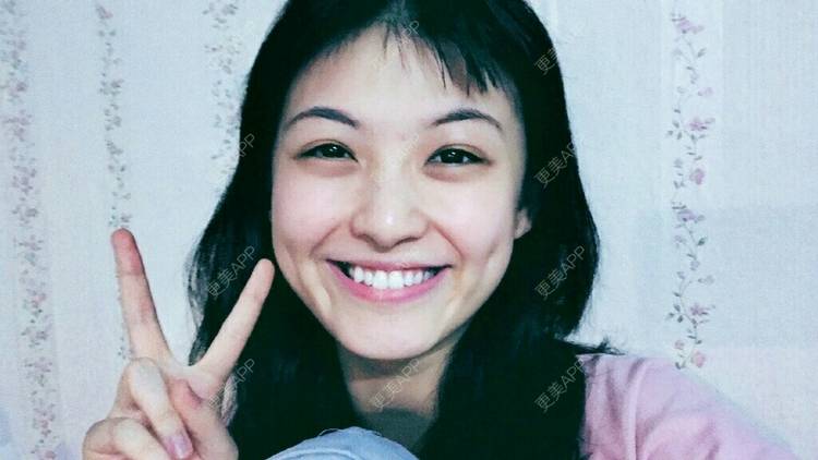 更美 - 春风吹梦的全瓷牙经验 | 成都 | 全瓷牙