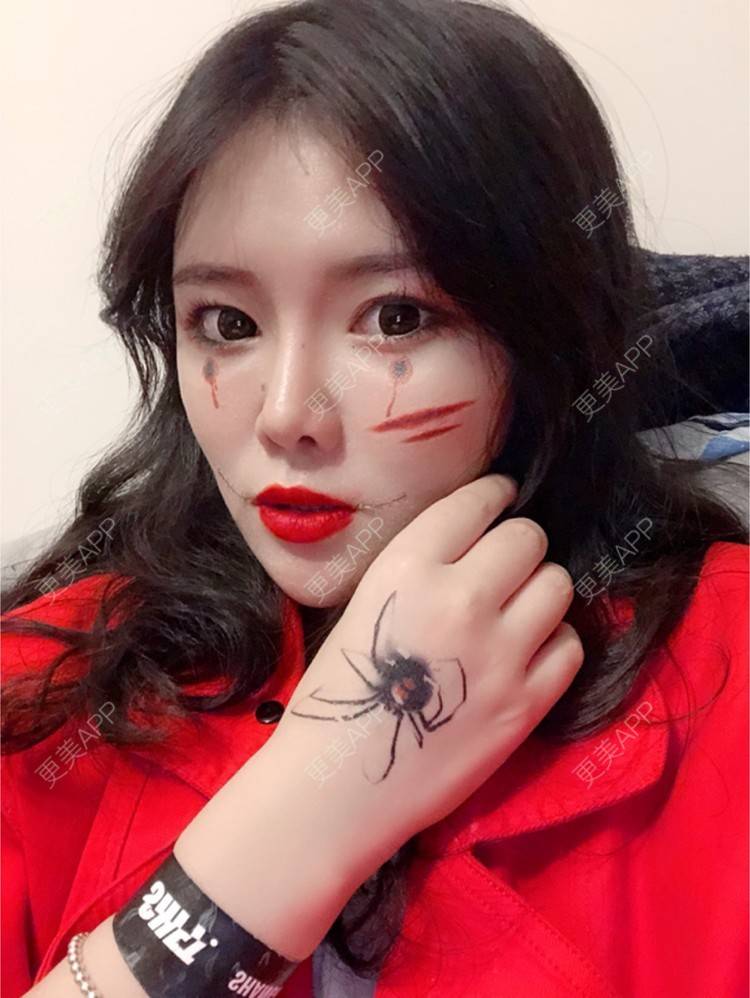 更美 - yuki666的玻尿酸经验 | 深圳 | 像素激光 | 鼻部综合 | 胸部修复 | 杭州 | 武汉 | 玻尿酸