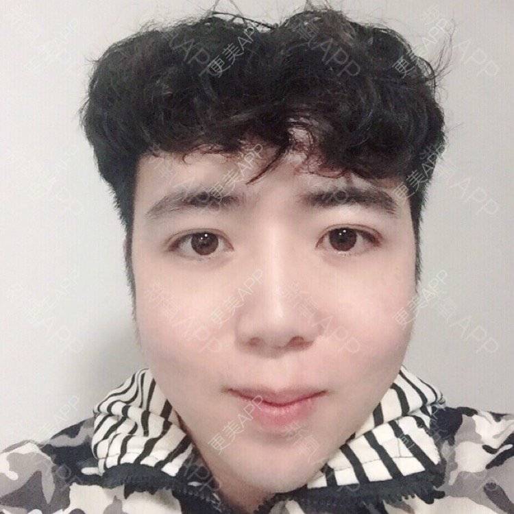 更美 - 叮当猫的时光机的硅胶垫下巴经验 | 硅胶垫下巴 | 杭州