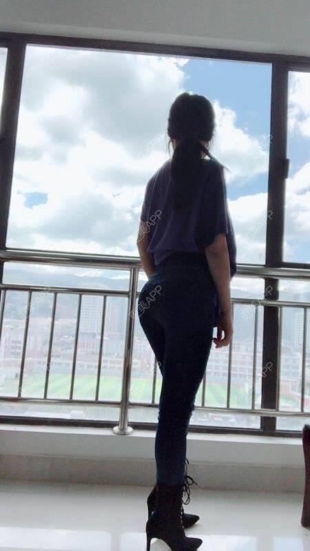 更美 - 更美用户5NSwwHUH8w的自体脂肪丰臀经验 | 成都 | 自体脂肪丰臀