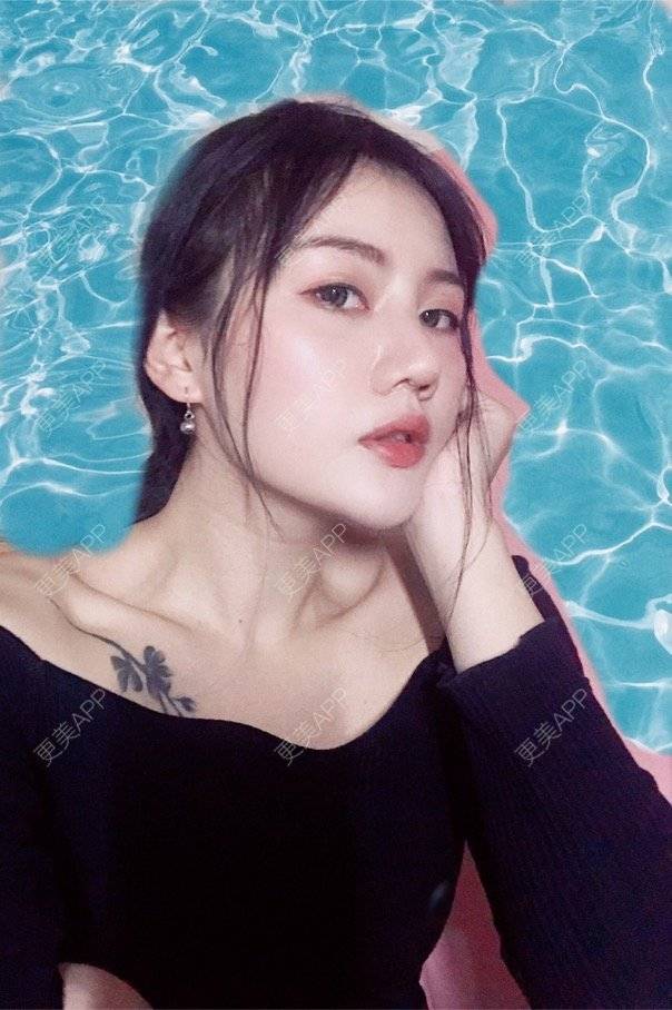 更美 - Kaleidoscope.的隆鼻经验 | 咸阳 | 隆鼻