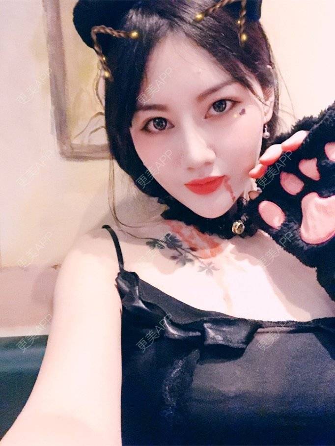 更美 - Kaleidoscope.的隆鼻经验 | 咸阳 | 隆鼻