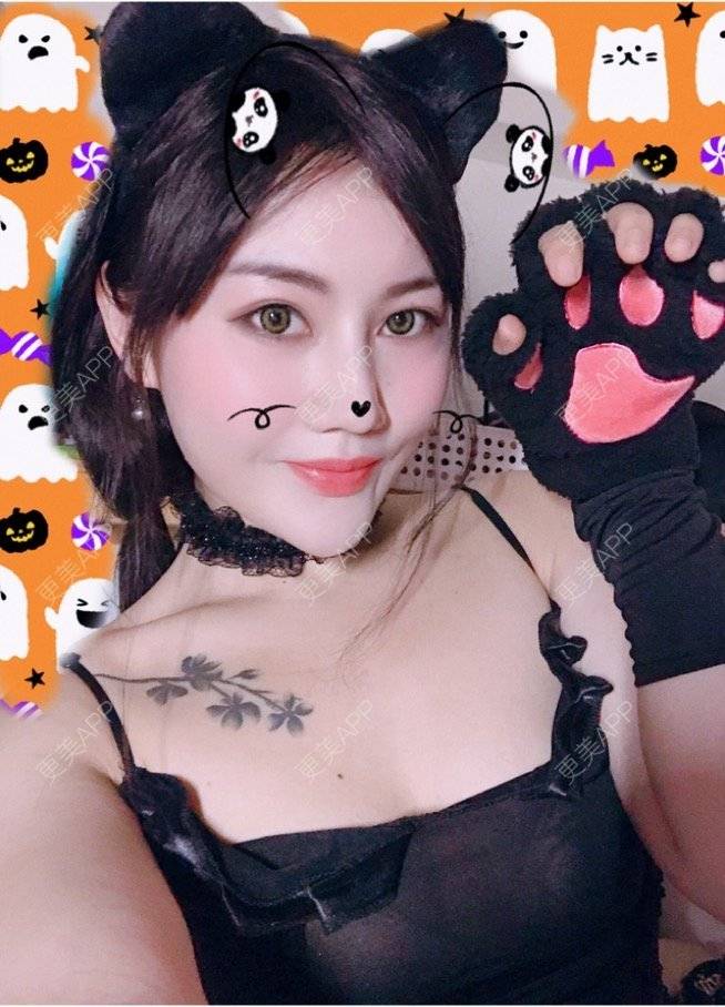 更美 - Kaleidoscope.的隆鼻经验 | 咸阳 | 隆鼻