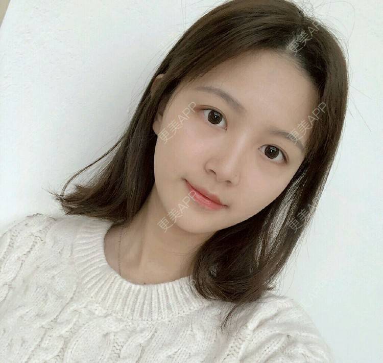 更美 - 雨争的拔龋齿经验 | 拔龋齿 | 成都