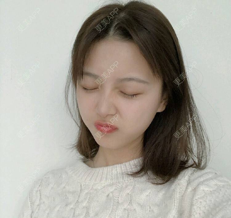 更美 - 雨争的拔龋齿经验 | 拔龋齿 | 成都