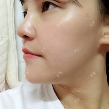 眼部多项
