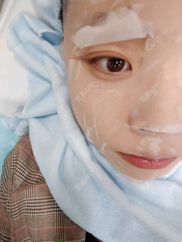 更美 - 更美用户zqZVBTAz1e的光子嫩肤经验 | 西安 | 自体脂肪丰面颊 | 北京 | 杭州 | 光子嫩肤 | 水光项目 | 下巴 | 上海 | 眼部多项 | 假体隆胸 | 除皱瘦脸 | 埋线双眼皮 | 超声溶脂 | 广州 | 激光脱毛 | 沈阳 | 深圳 | 南京 | 全瓷牙