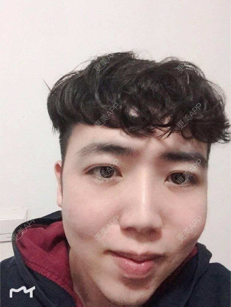 更美 - 叮当猫的时光机的硅胶垫下巴经验 | 硅胶垫下巴 | 杭州