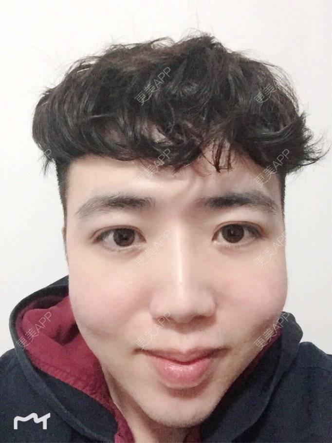 更美 - 叮当猫的时光机的硅胶垫下巴经验 | 硅胶垫下巴 | 杭州