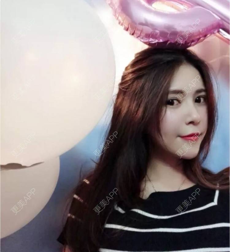 更美 - 小福多水晶的经验 | 西安 | 酒窝成形 | 宁波 | 北京 | 埋线提升 | 定点双眼皮 | 武汉 | 双眼皮 | 上海 | 注射塑形腿部 | 除皱瘦脸 | 乳头内陷矫正 | 广州 | 南昌 | 女性私密 | 深圳 | 吸脂