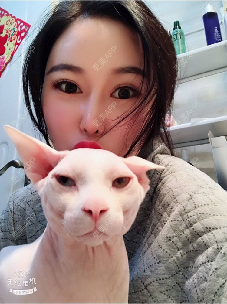 更美 - 18*******27的玻尿酸经验 | 眼部修复 | 眼部综合 | 北京 | 美白套餐 | 皮肤综合管理套餐 | 双眼皮 | 上海 | 祛眼袋 | 西安 | 武汉 | 长沙 | 广州 | 南昌 | 深圳 | 玻尿酸 | 祛斑祛色素 | 激光脱毛 | 杭州 | 注射塑形腿部 | 下巴 | 大连 | 除皱瘦脸 | 吸脂瘦脸 | 埋线提升