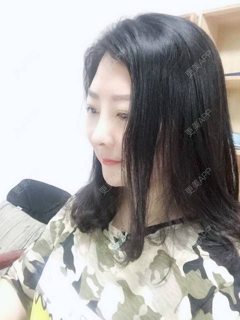 更美 - 更美用户6DhZGpqnCz的鼻部综合经验 | 眼部修复 | 丰胸（隆胸） | 鼻部多项 | 酒窝成形 | 水光项目 | 双眼皮 | 祛斑祛色素 | 隆鼻 | 彩光嫩肤 | 牙齿美白 | 洗牙 | 牙贴面 | 玻尿酸 | 自体脂肪隆胸 | 肋软骨隆鼻 | 吸脂 | 瘦脸除皱 | 小气泡 | 激光淡化红血丝 | 女性私密 | 鼻部综合 | 武汉