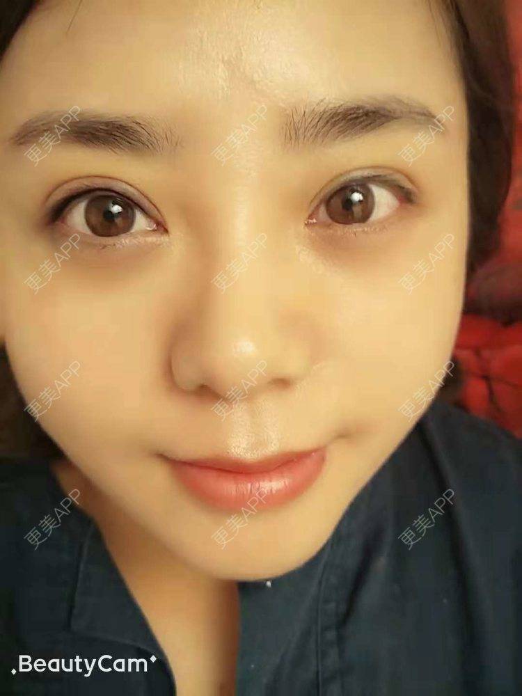 更美 - 更美用户Y53MssAB87的半永久纹眼线经验 | 半永久纹眼线 | 长春