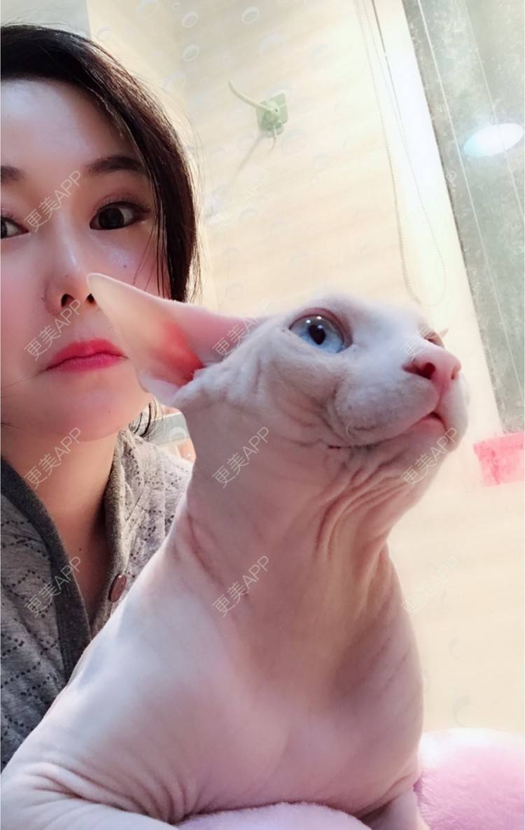 更美 - 18*******27的玻尿酸经验 | 眼部修复 | 眼部综合 | 北京 | 美白套餐 | 皮肤综合管理套餐 | 双眼皮 | 上海 | 祛眼袋 | 西安 | 武汉 | 长沙 | 广州 | 南昌 | 深圳 | 玻尿酸 | 祛斑祛色素 | 激光脱毛 | 杭州 | 注射塑形腿部 | 下巴 | 大连 | 除皱瘦脸 | 吸脂瘦脸 | 埋线提升