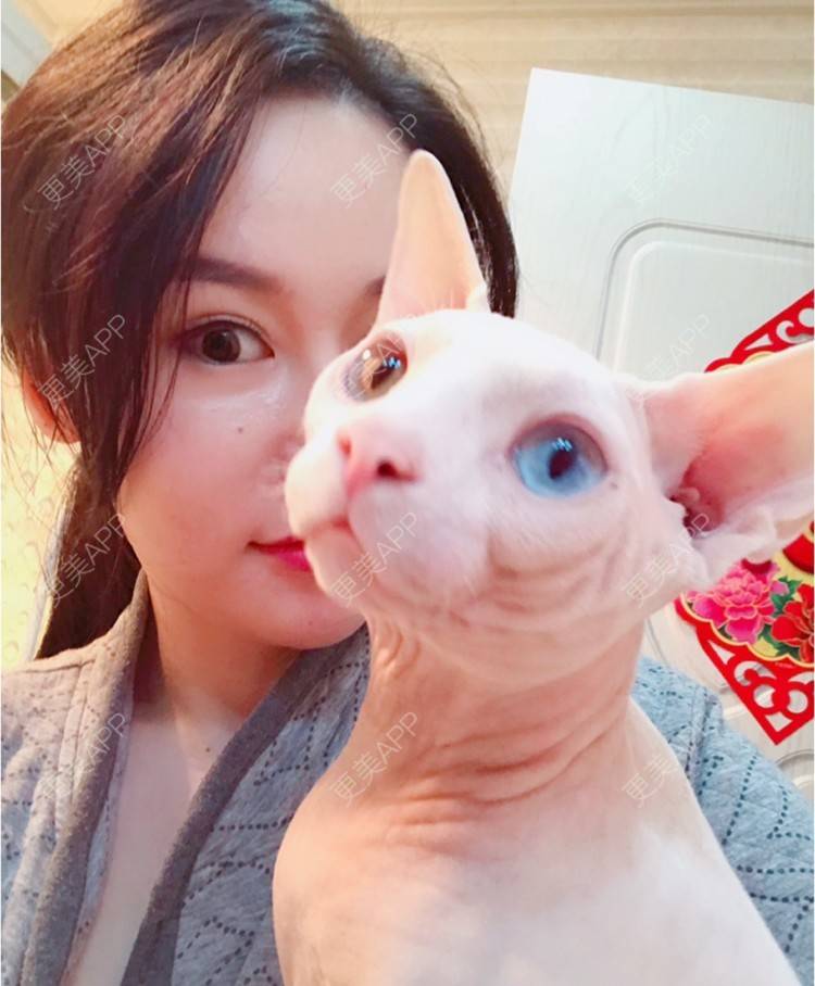 更美 - 18*******27的玻尿酸经验 | 眼部修复 | 眼部综合 | 北京 | 美白套餐 | 皮肤综合管理套餐 | 双眼皮 | 上海 | 祛眼袋 | 西安 | 武汉 | 长沙 | 广州 | 南昌 | 深圳 | 玻尿酸 | 祛斑祛色素 | 激光脱毛 | 杭州 | 注射塑形腿部 | 下巴 | 大连 | 除皱瘦脸 | 吸脂瘦脸 | 埋线提升