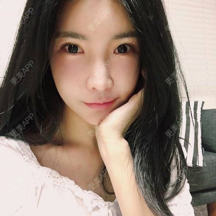 更美 - 更美用户6SEYjuGSWd的小气泡经验 | 丰胸（隆胸） | 西安 | 激光脱毛 | 北京 | 埋线提升 | 水光项目 | 洗牙 | 上海 | 郑州 | 激光淡斑 | 小气泡 | 南京