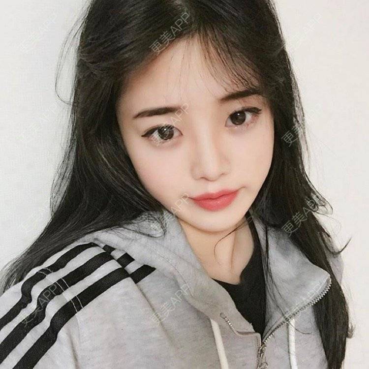 更美 - 更美用户eyOBy9X0PU的经验 | 丰胸（隆胸） | 西安 | 激光脱毛 | 北京 | 埋线提升 | 水光项目 | 除皱 | 上海 | 郑州 | 南京 | 洗牙 | 拔牙 | 小气泡 | 激光淡斑