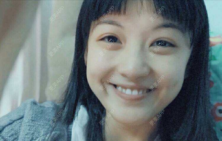 更美 - 春风吹梦的全瓷牙经验 | 成都 | 全瓷牙
