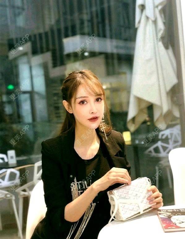 更美 - Abby吴晓辰的埋线提升经验 | 埋线提升 | 视频日记